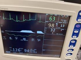 Criticare 81h001pd Csi Ncompass Patient Monitor Etco2 Capnography Printer