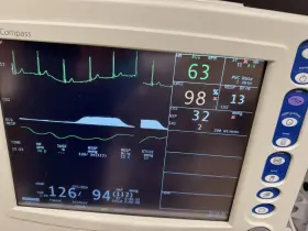 81h001pd Criticare Csi Ncompass Patient Monitor Etco2 Capnography Printer 81h001pd Criticare Csi Ncompass Patient Monitor Etco2 Capnography Printer