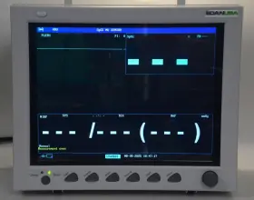 260605 Edan Usa Im8 Vital Signs Patient Monitor Ecg Spo2 Co2 Nibp Temp