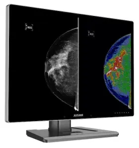 C1210g Jusha Radiology Diagnostic Monitor 12 Mp Color