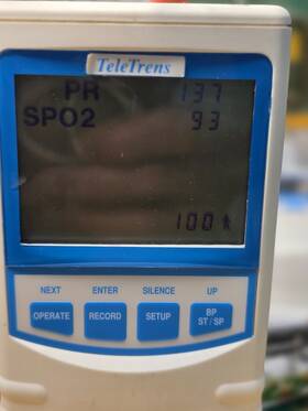 Lsi Tm10 Life Sensing Telemaster Patient Monitoring System