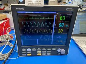 Mindray 6100f-pa00195 Datascope Passport V With Etc02 Ecg Sp02 Masimo Nibp Temp Ibp