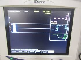 Smiths Medical 92m774325a Dvisor Model 9200 Vital Signs Monitor Biomed Checked Thru 9/24