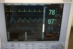 Datascope Passport - Ecg, Masimo SP02, Nibp, ETCO2, Color Screen, Printer Seller. Price: $1250.00.