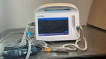Welch Allyn Connex 6000 Vital Signs Monitor SPO2, Nibp Bp, Temp &new Battery Seller. Price: $375.00.
