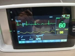 Ge Carescape One Version 3 Transport Monitor Loaded With Ed, Nicu, Or,pacu Seller. Price: $3295.00.
