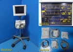Datascope Passport Xg Patient Monitor W/ Rolling Stand & Accessories 38063 Used. Price: $422.99.