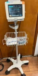 Philips Intellivue 865024 MP5 W/ CO2, SPO2, Ecg, Nibp, Printer & Cables (F007) Used. Price: $819.00.