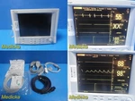 Datascope Passport 2 Patient Monitor W/ Ecg Nibp Accessories & Mount 39693 Used. Price: $444.99.
