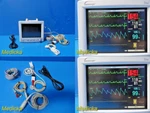 Datascope Trio P/n 0998-00-0600-4009A Monitor W/ Patient Leads 31018 Used. Price: $388.99.