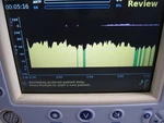 Hospira Physiometrix Sedline EN-2 Patient Monitor 20738-04-04 Used. Price: $30.00.