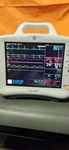 Ge Dash 3000 Patient Monitor Seller. Price: $650.00.