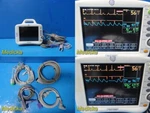 2008 Ge Dash 3000 (p/n 2035598-103) Patient Monitor W/ ECG,NBP,SPO2 Leads 28803 Used. Price: $436.99.