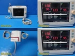Philips Sure Signs VS3 Ref 863070 Spot Vitals Monitor W/ Patient Leads 30610 Used. Price: $234.99.