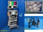 Smith&nephew 560P Arthroscopy Sys W/ Camera, Ccu, Light, Monitor Shaver 36278 Used. Price: $5095.99.