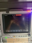 Mindray DPM6 Patient Monitor Used. Price: $199.00.