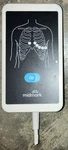 Midmark Digital Ecg With Lead Management 1-100-1550 2023 For Parts As-is. Price: $1500.00.