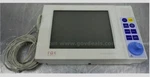 Zoe Medical Nightingale PPM2 Monitor 179-0001 Used. Price: $1685.00.